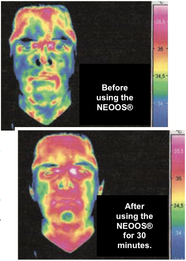 beforeafter.png